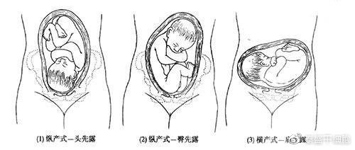 胎头入骨盆，怀孕几个月的重要里程碑